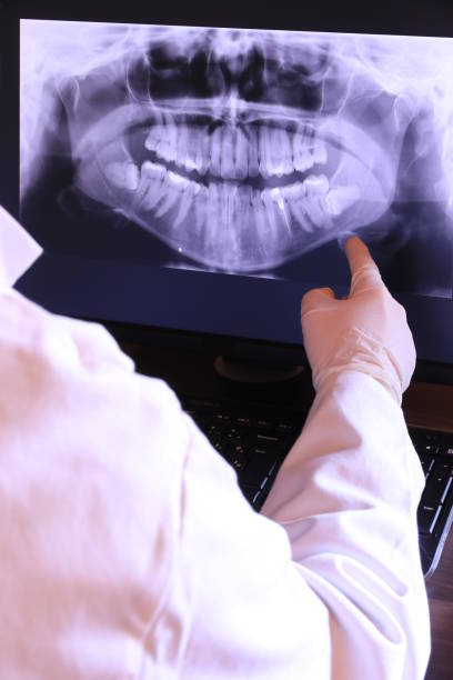 Best Dentist for Tooth Abscess  in Alamo, NV